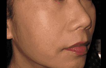 Essence of Beauty After 302 Skincare in 2008