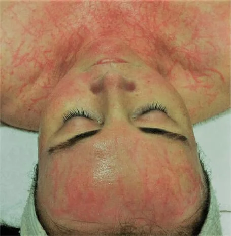 DMK Enzyme Therapy Plasmatic Effect